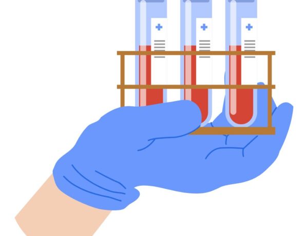 Jakie badania zrobić lista badań na NFZ jadietetyk